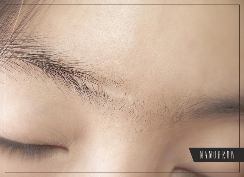 Makeup para matakpan ang mga peklat